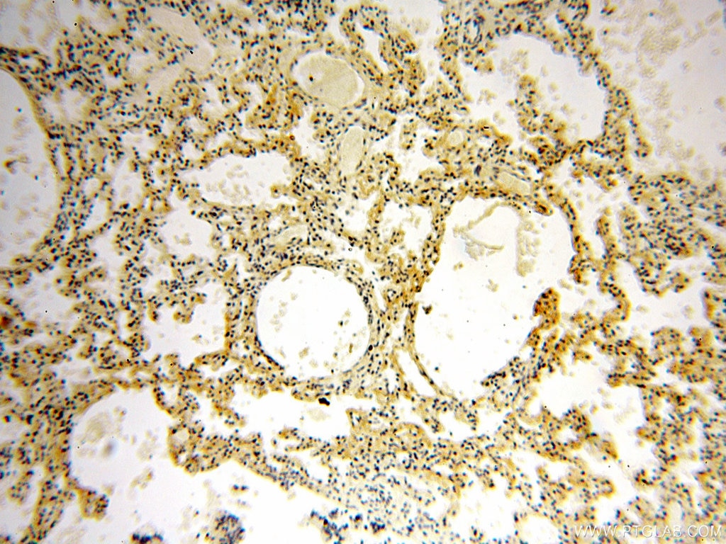IHC staining of human lung using 17870-1-AP