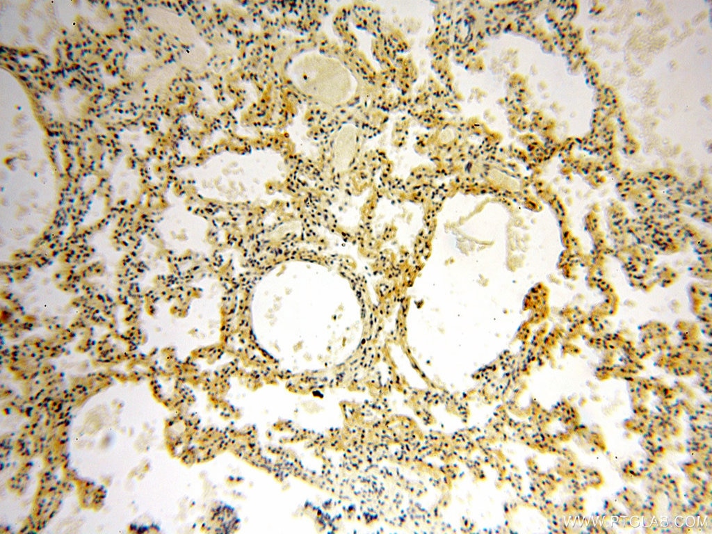 Immunohistochemistry (IHC) staining of human lung tissue using STS Polyclonal antibody (17870-1-AP)