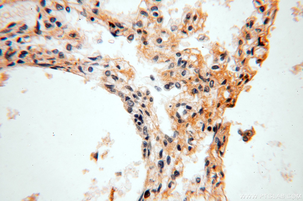 Immunohistochemistry (IHC) staining of human lung tissue using STS Polyclonal antibody (17870-1-AP)