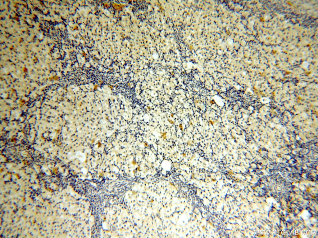 Immunohistochemistry (IHC) staining of human ovary tissue using STS Polyclonal antibody (17870-1-AP)