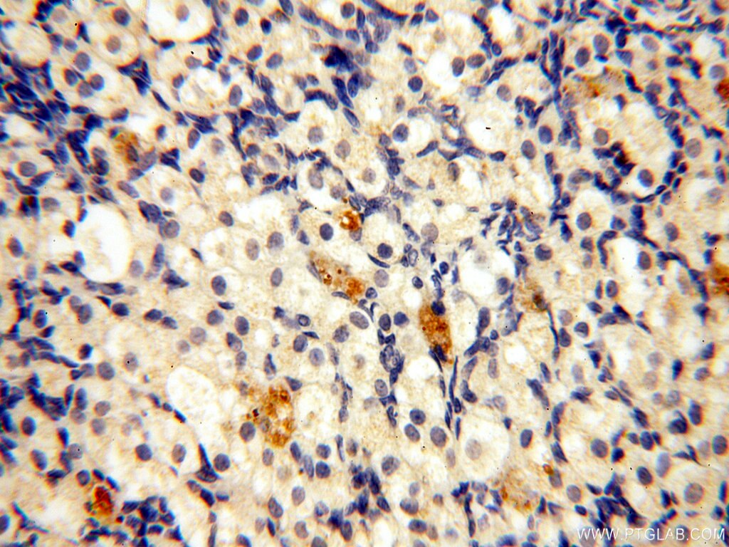 Immunohistochemistry (IHC) staining of human ovary tissue using STS Polyclonal antibody (17870-1-AP)