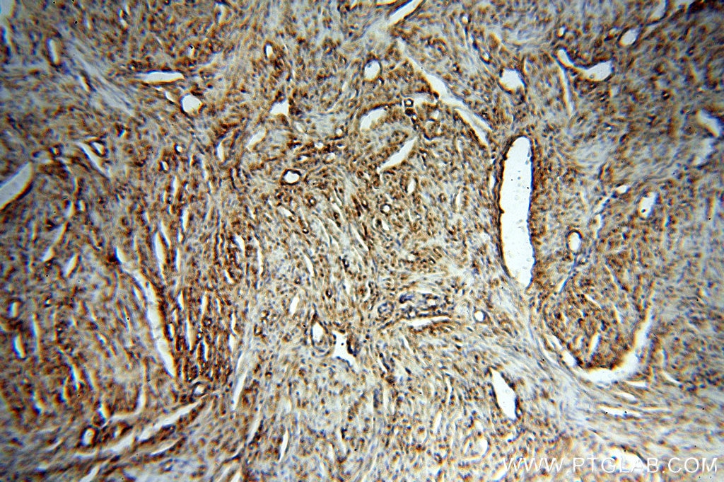 IHC staining of human paracancerous tissue of hysteromyoma using 17870-1-AP
