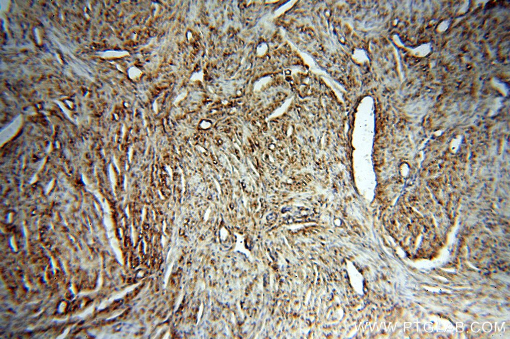 Immunohistochemistry (IHC) staining of human paracancerous tissue of hysteromyoma using STS Polyclonal antibody (17870-1-AP)