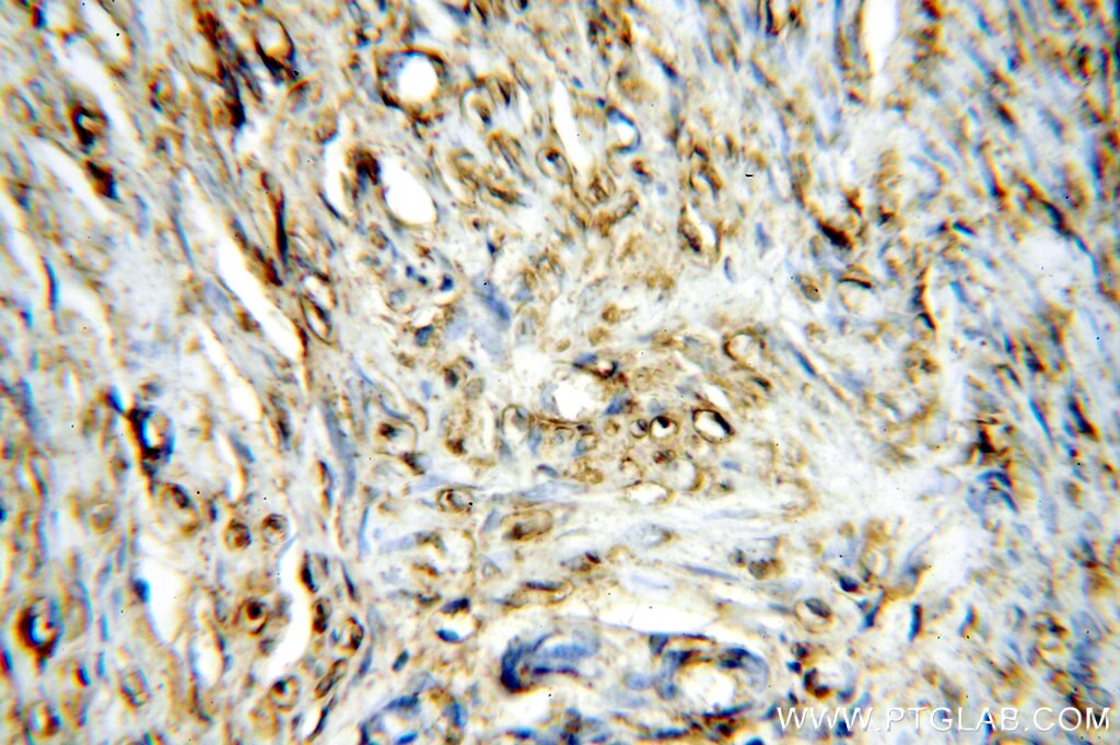 Immunohistochemistry (IHC) staining of human paracancerous tissue of hysteromyoma using STS Polyclonal antibody (17870-1-AP)