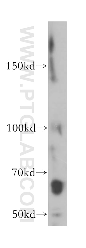 Western Blot (WB) analysis of MCF-7 cells using STS Polyclonal antibody (17870-1-AP)