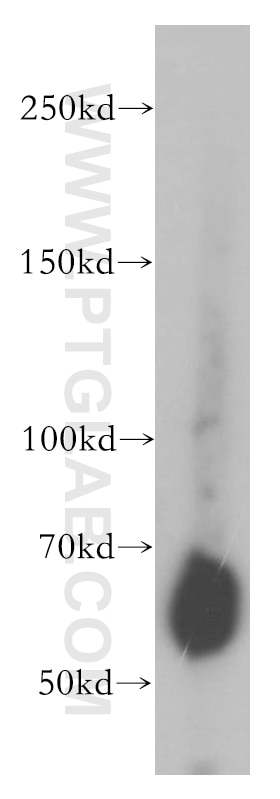 Western Blot (WB) analysis of human placenta tissue using STS Polyclonal antibody (17870-1-AP)