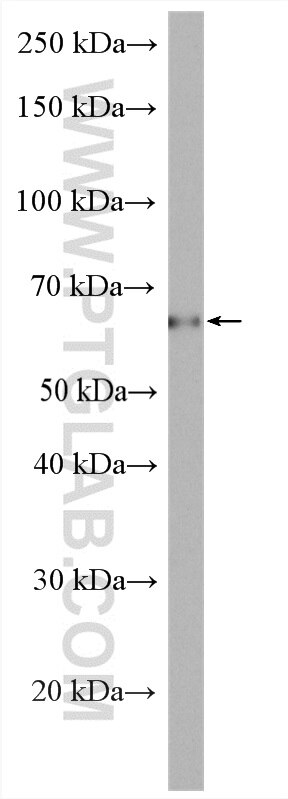 Western Blot (WB) analysis of K-562 cells using STT3A Polyclonal antibody (12034-1-AP)