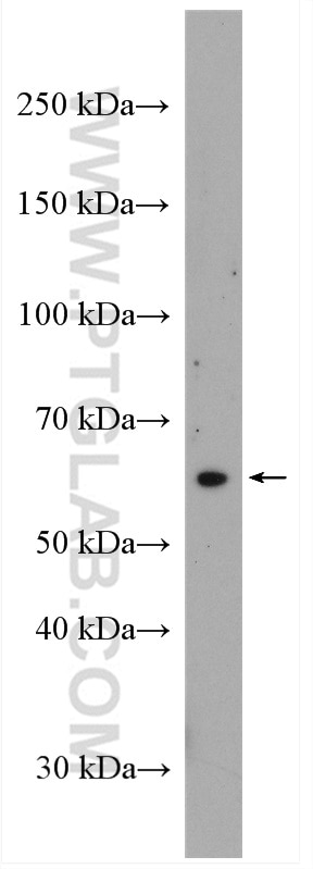 Western Blot (WB) analysis of HepG2 cells using STT3A Polyclonal antibody (12034-1-AP)