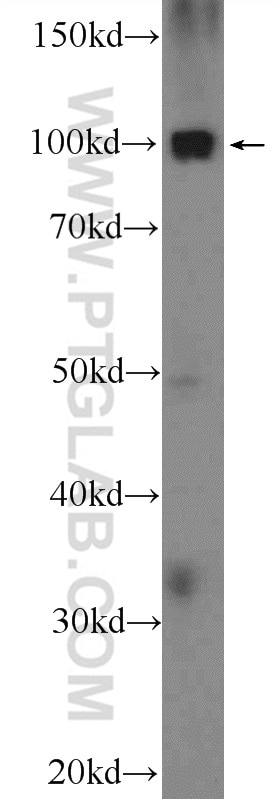 STT3A Polyclonal antibody