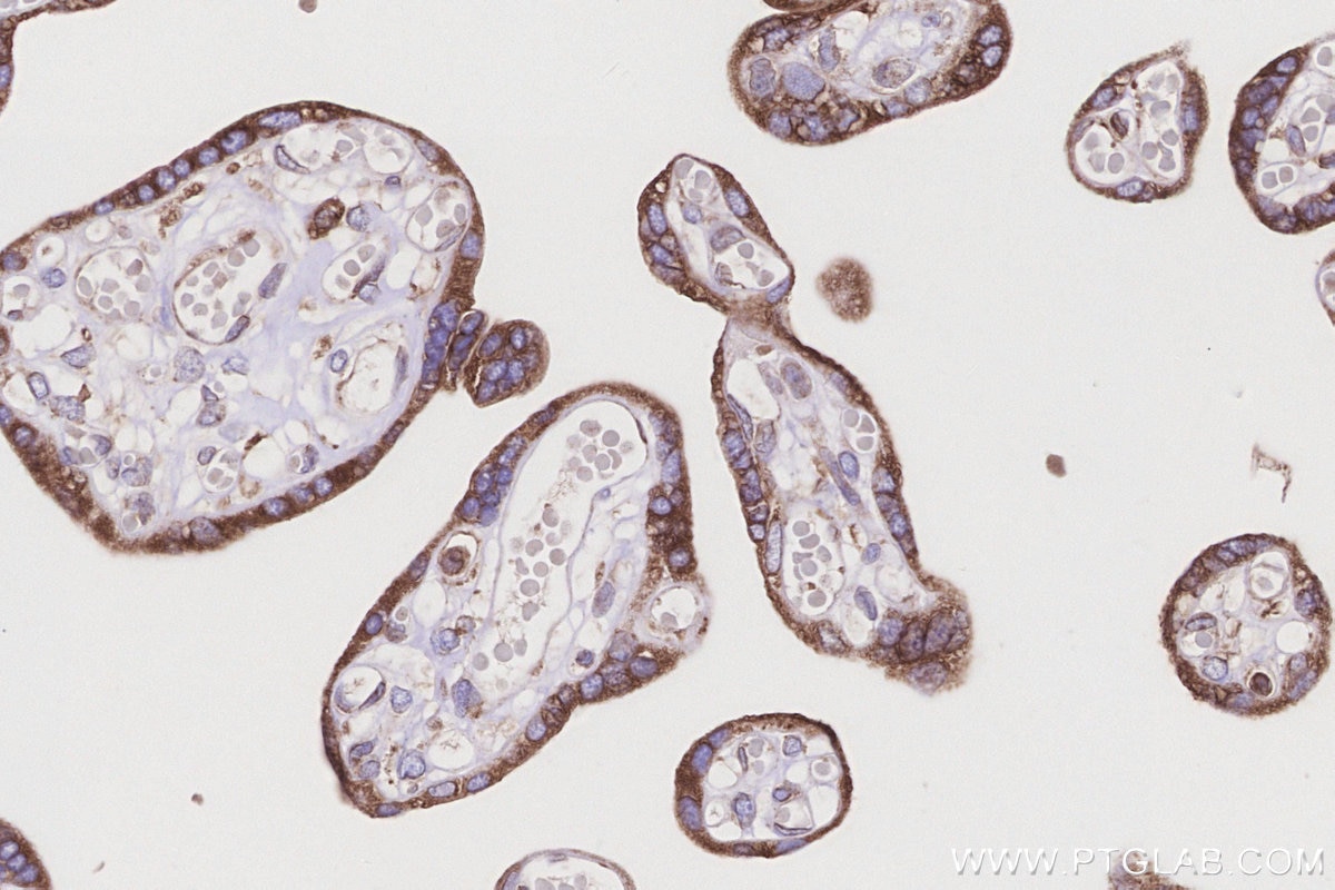 Immunohistochemistry (IHC) staining of human placenta tissue using STT3A Monoclonal antibody (66581-1-Ig)