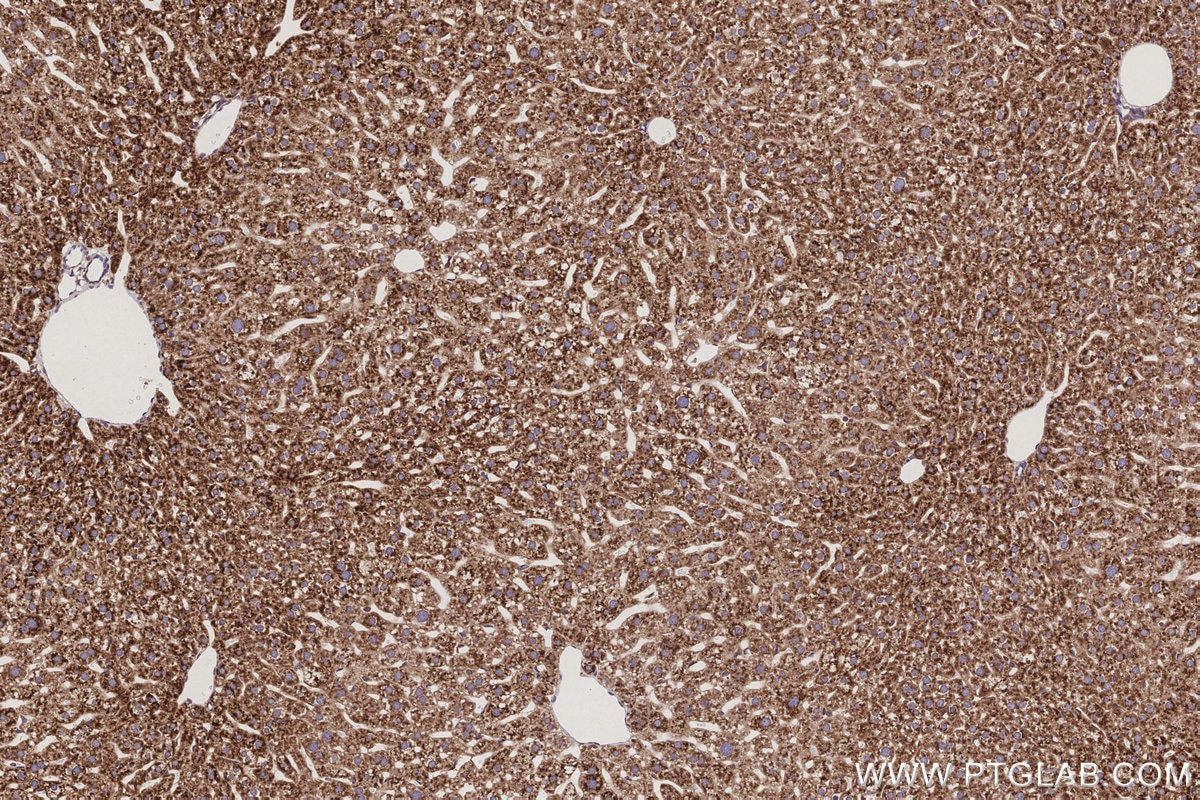 Immunohistochemistry (IHC) staining of mouse liver tissue using STT3A Monoclonal antibody (66581-1-Ig)