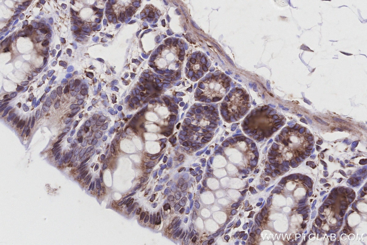 Immunohistochemistry (IHC) staining of rat colon tissue using STT3A Monoclonal antibody (66581-1-Ig)
