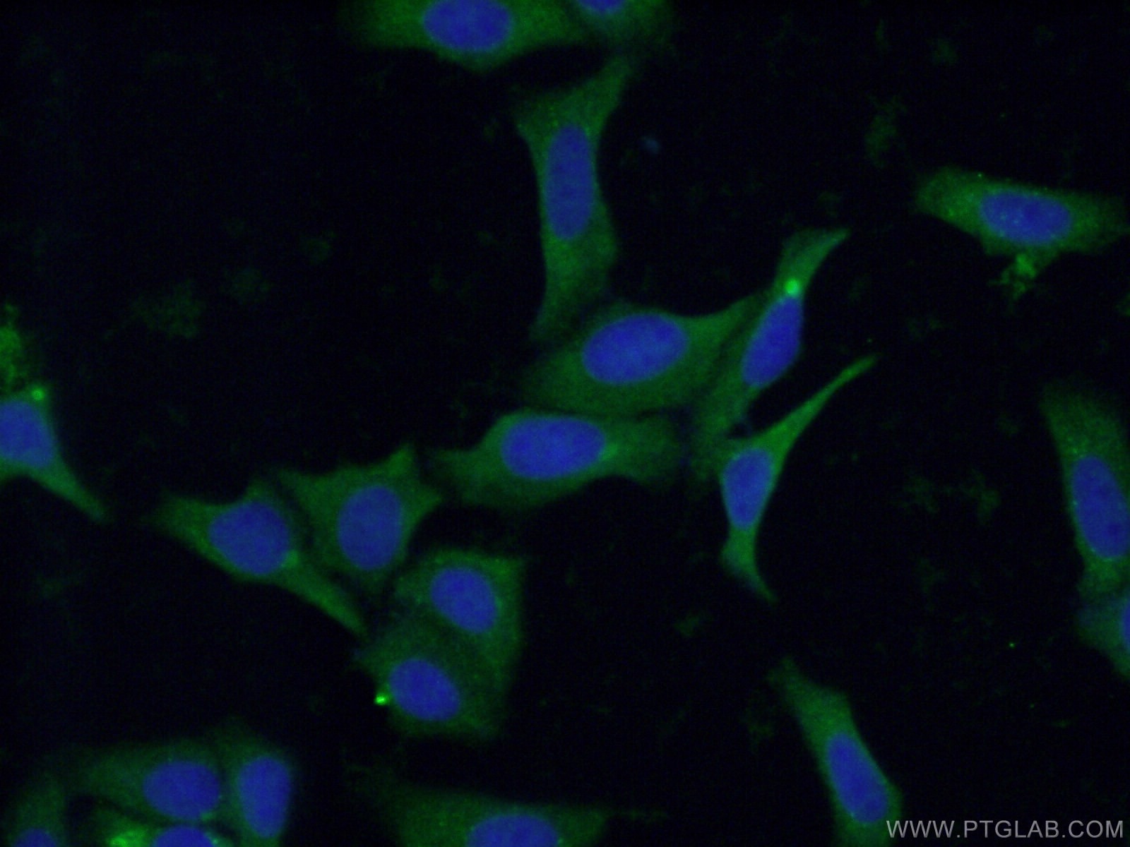 Immunofluorescence (IF) / fluorescent staining of HepG2 cells using STT3B Polyclonal antibody (15323-1-AP)