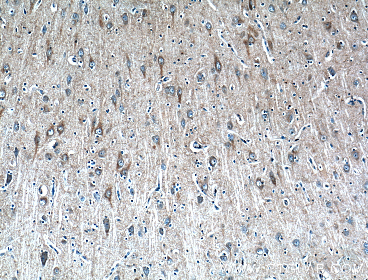 Immunohistochemistry (IHC) staining of human brain tissue using STT3B Polyclonal antibody (15323-1-AP)