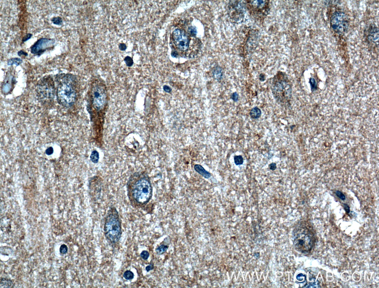 Immunohistochemistry (IHC) staining of human brain tissue using STT3B Polyclonal antibody (15323-1-AP)