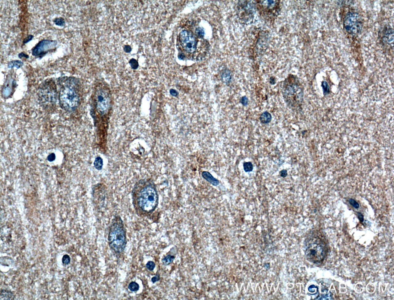 Immunohistochemistry (IHC) staining of human brain tissue using STT3B Polyclonal antibody (15323-1-AP)