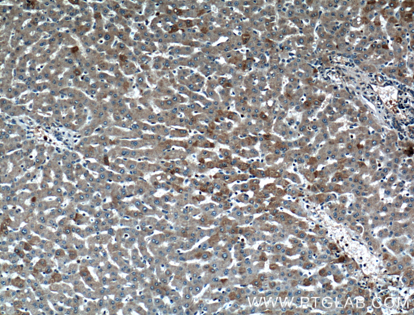 Immunohistochemistry (IHC) staining of human liver tissue using STT3B Polyclonal antibody (15323-1-AP)