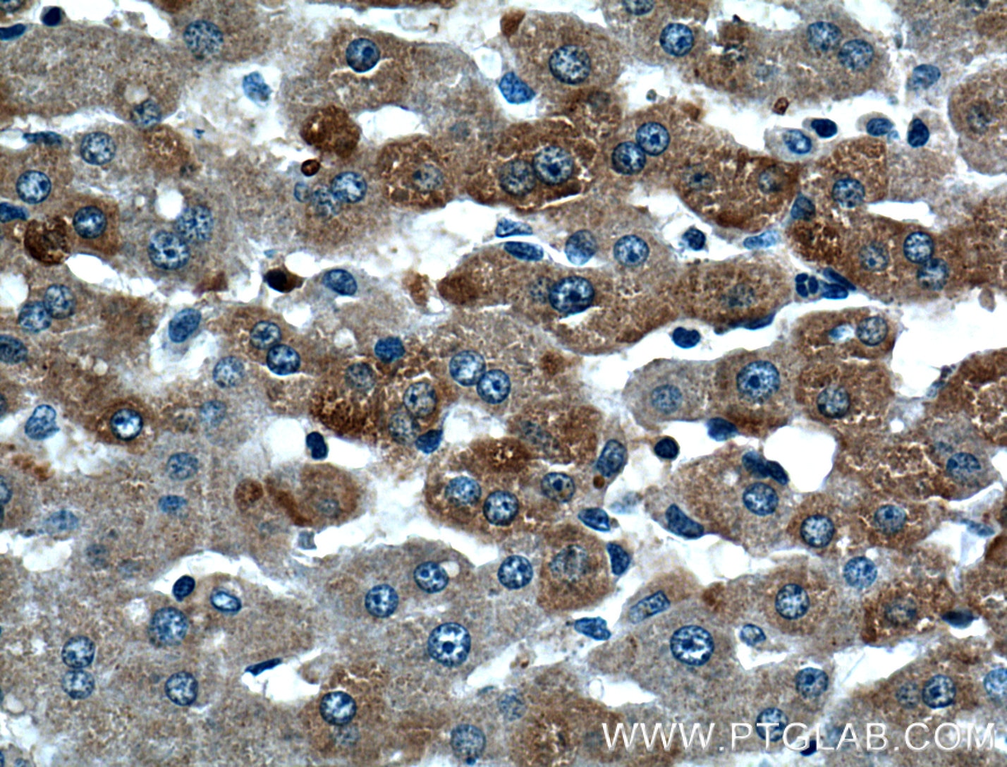 Immunohistochemistry (IHC) staining of human liver tissue using STT3B Polyclonal antibody (15323-1-AP)