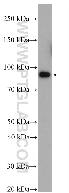 Western Blot (WB) analysis of rat liver tissue using STT3B Polyclonal antibody (15323-1-AP)
