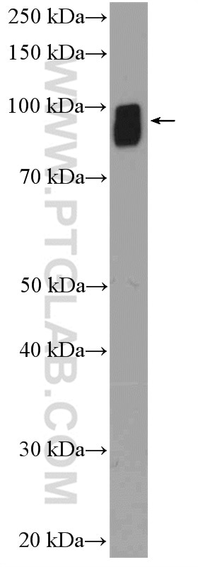 Western Blot (WB) analysis of mouse liver tissue using STT3B Polyclonal antibody (15323-1-AP)