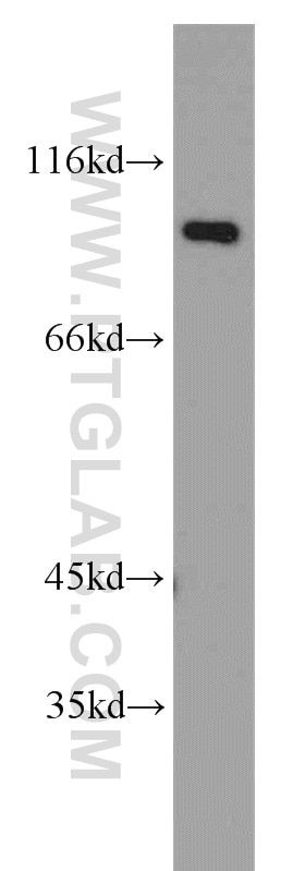 Western Blot (WB) analysis of human brain tissue using STT3B Polyclonal antibody (15323-1-AP)