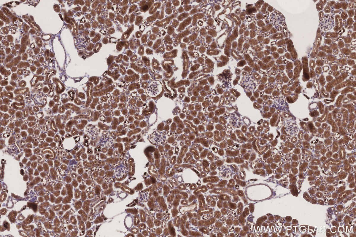 Immunohistochemistry (IHC) staining of mouse kidney tissue using STT3B Monoclonal antibody (68496-1-Ig)