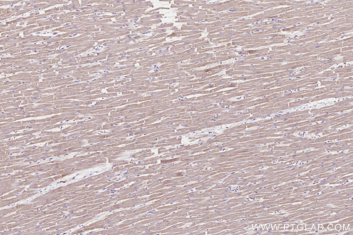 Immunohistochemistry (IHC) staining of human heart tissue using STT3B Monoclonal antibody (68496-1-Ig)