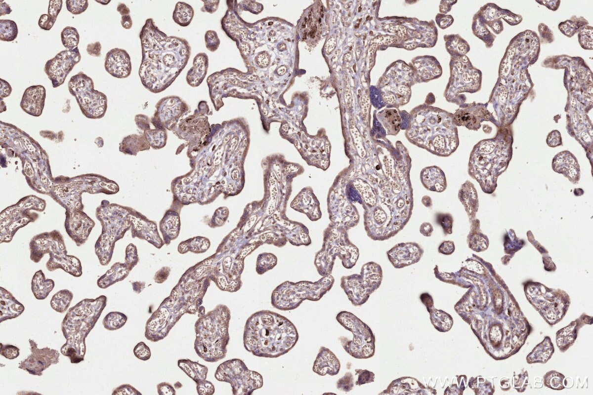 Immunohistochemistry (IHC) staining of human placenta tissue using STT3B Monoclonal antibody (68496-1-Ig)