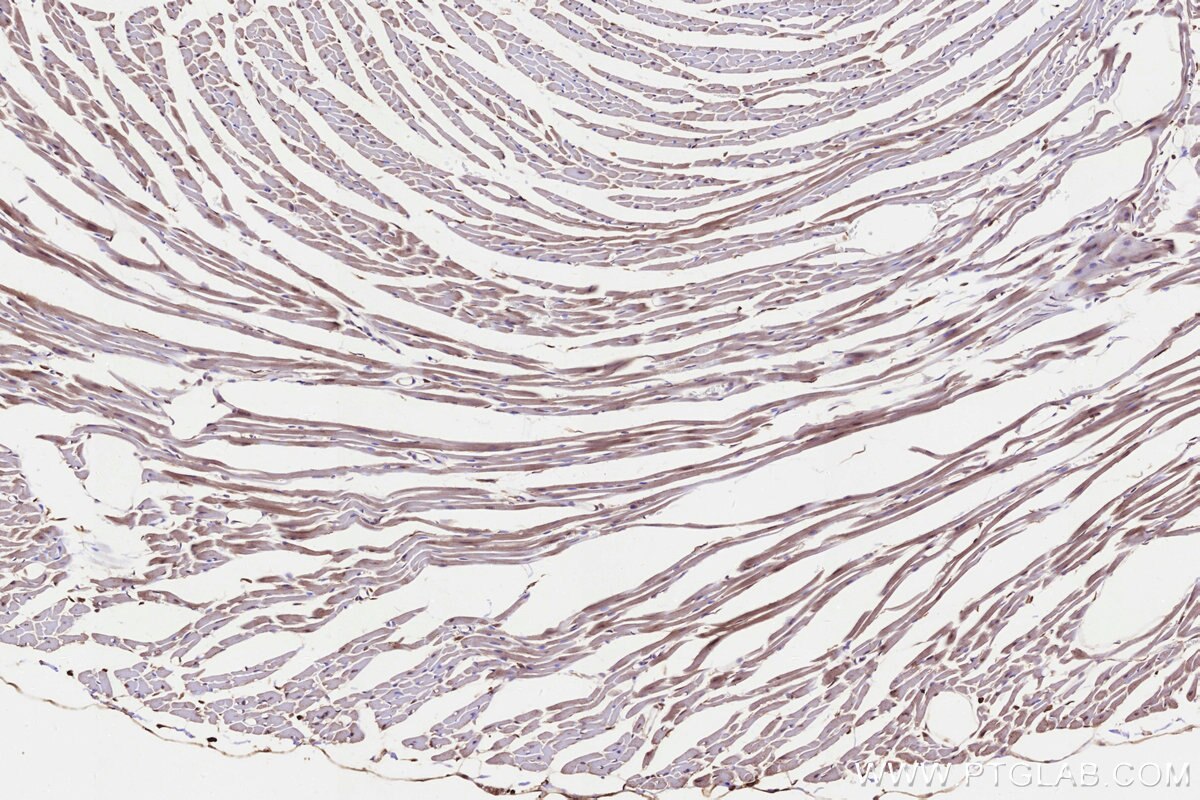 Immunohistochemistry (IHC) staining of mouse heart tissue using STT3B Monoclonal antibody (68496-1-Ig)