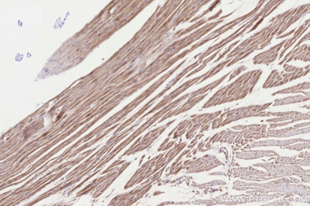 Immunohistochemistry (IHC) staining of rat heart tissue using STT3B Monoclonal antibody (68496-1-Ig)