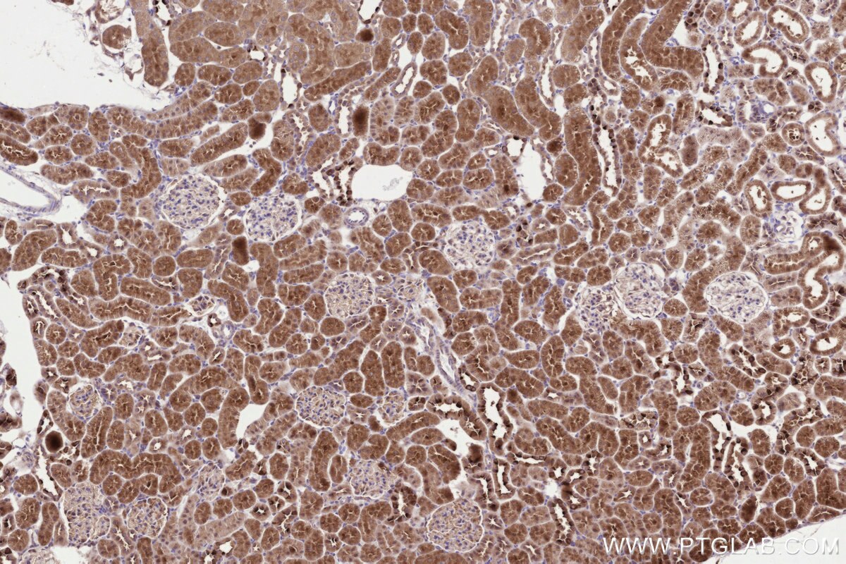 Immunohistochemistry (IHC) staining of rat kidney tissue using STT3B Monoclonal antibody (68496-1-Ig)