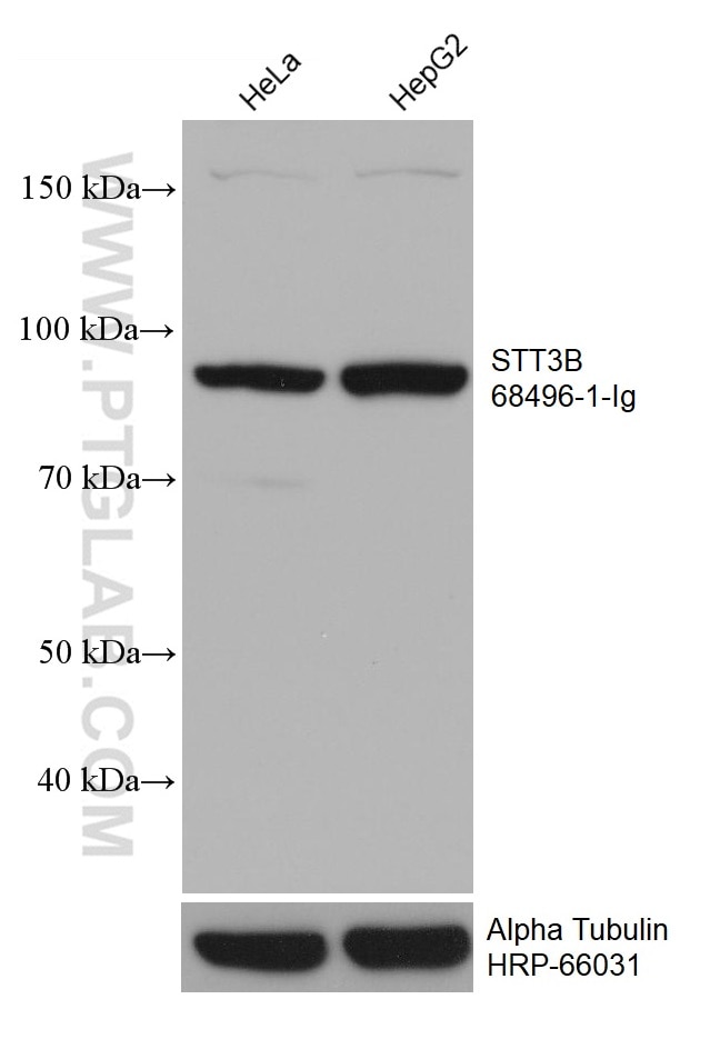 Western Blot (WB) analysis of various lysates using STT3B Monoclonal antibody (68496-1-Ig)