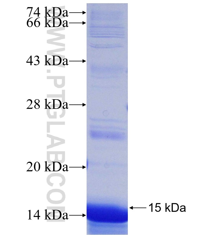 STT3B fusion protein Ag30866 SDS-PAGE