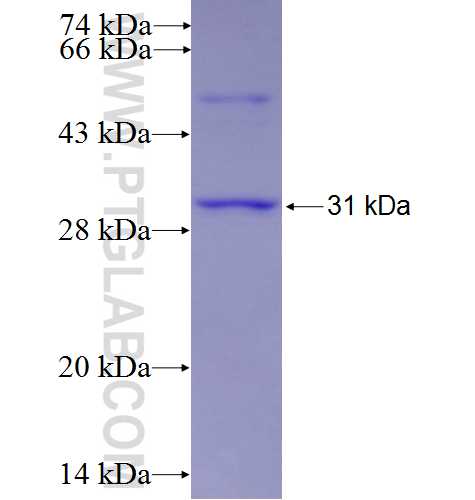 STT3B fusion protein Ag2039 SDS-PAGE