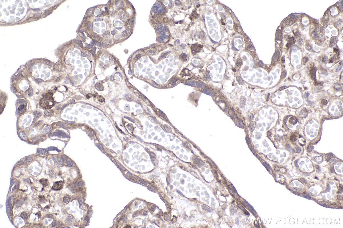 Immunohistochemistry (IHC) staining of human placenta tissue using STUB1 Polyclonal antibody (29751-1-AP)