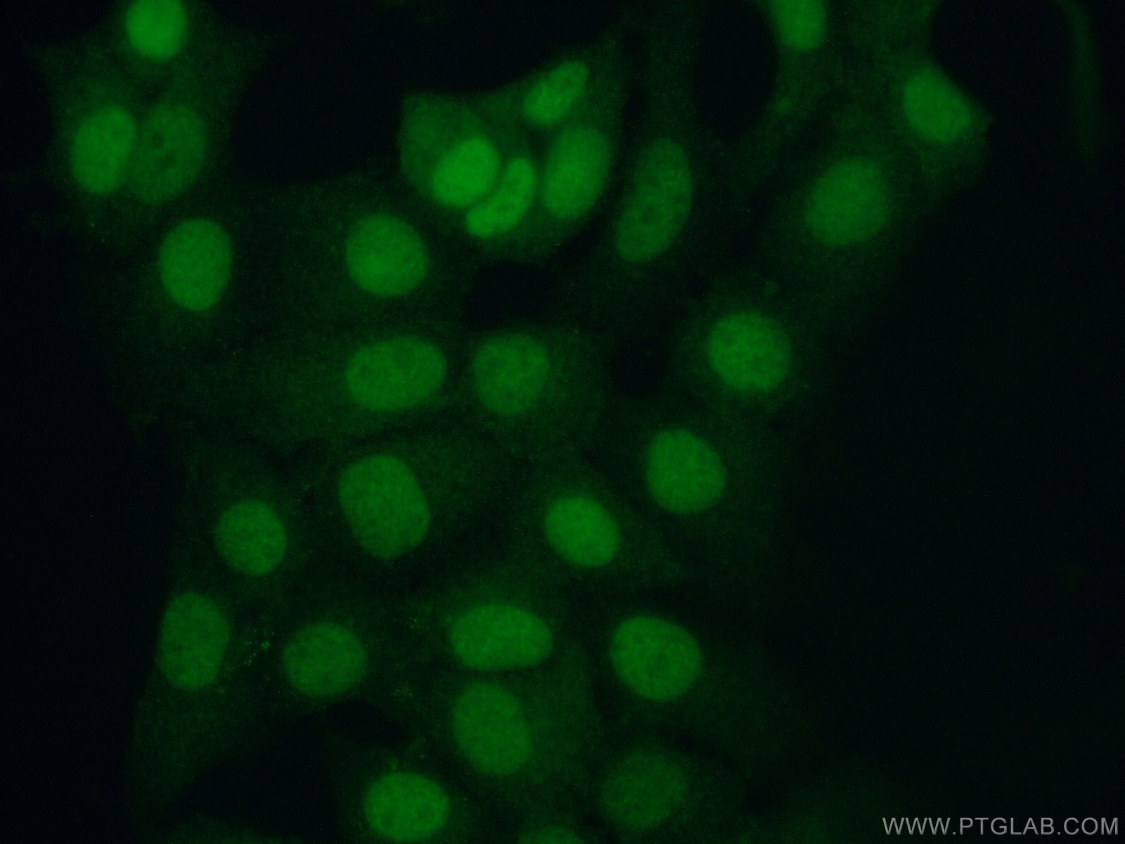 Immunofluorescence (IF) / fluorescent staining of MCF-7 cells using STUB1 Polyclonal antibody (55430-1-AP)