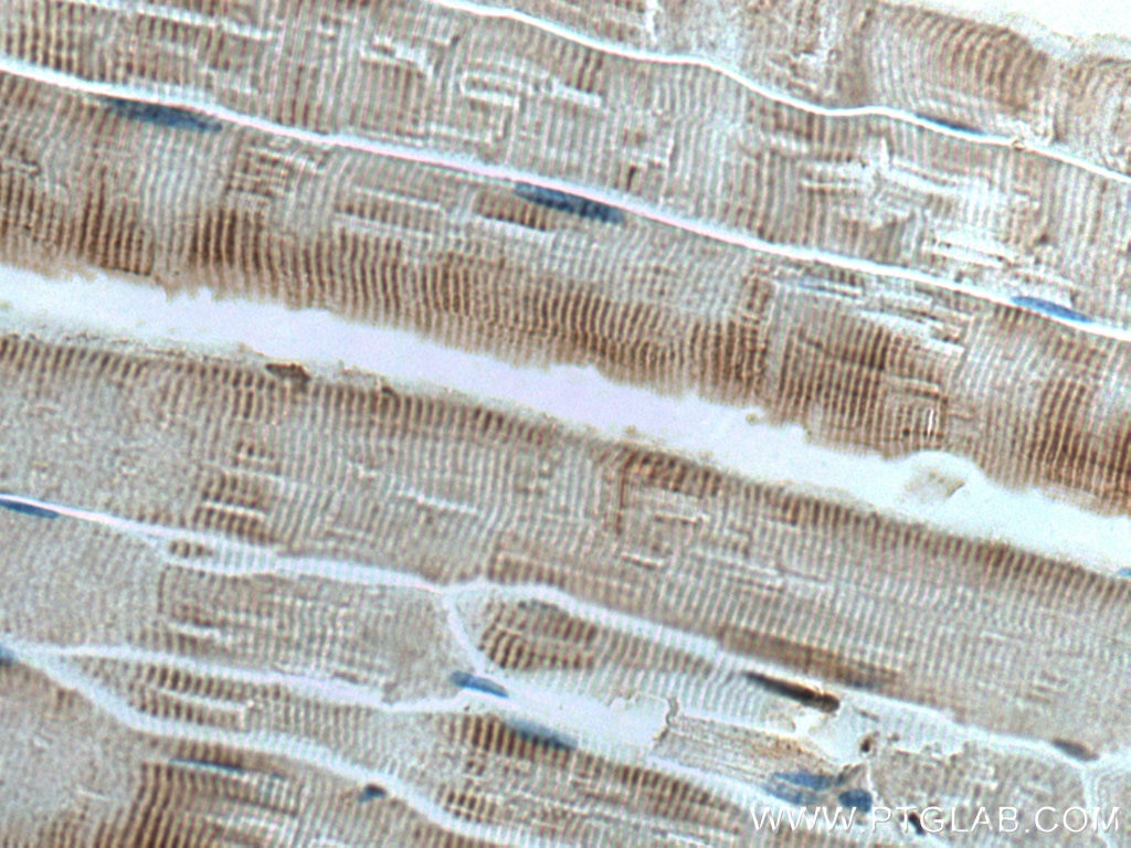 Immunohistochemistry (IHC) staining of mouse skeletal muscle tissue using STUB1 Polyclonal antibody (55430-1-AP)