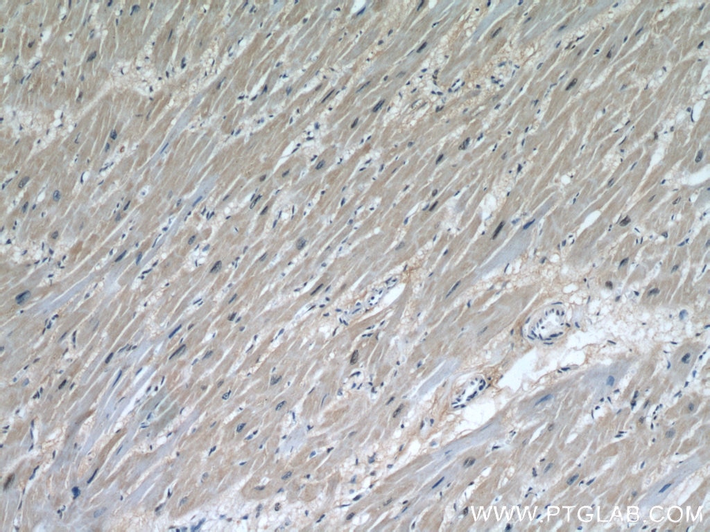Immunohistochemistry (IHC) staining of human heart tissue using STUB1 Polyclonal antibody (55430-1-AP)