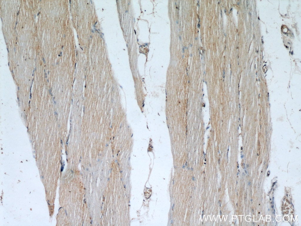 Immunohistochemistry (IHC) staining of human skeletal muscle tissue using STUB1 Polyclonal antibody (55430-1-AP)