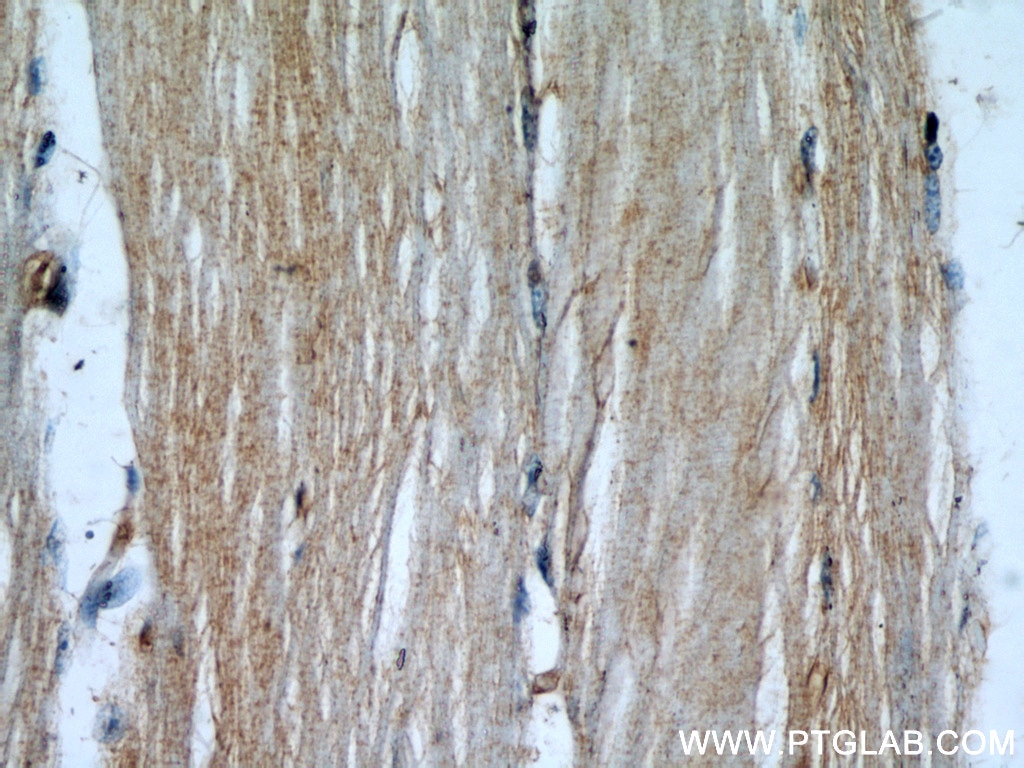 Immunohistochemistry (IHC) staining of human skeletal muscle tissue using STUB1 Polyclonal antibody (55430-1-AP)