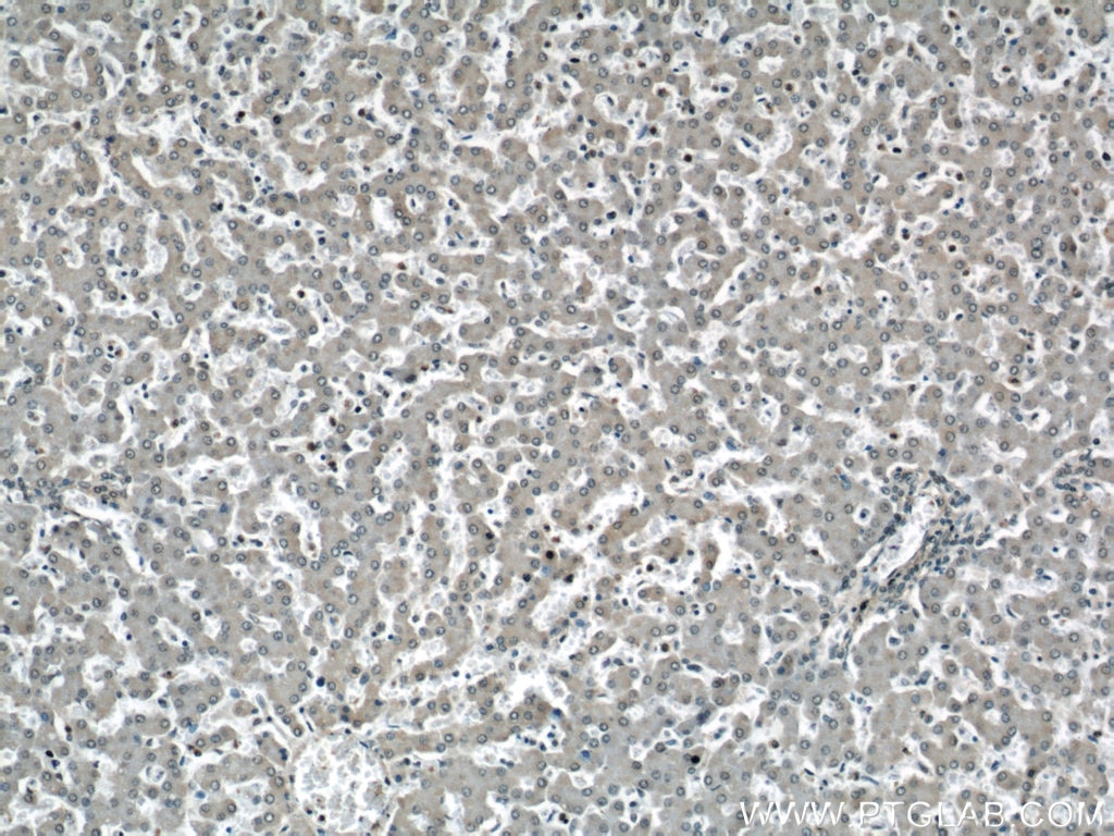 Immunohistochemistry (IHC) staining of human liver tissue using STUB1 Polyclonal antibody (55430-1-AP)