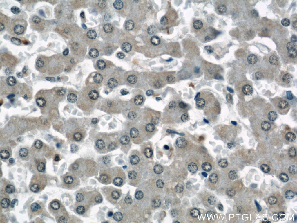 Immunohistochemistry (IHC) staining of human liver tissue using STUB1 Polyclonal antibody (55430-1-AP)