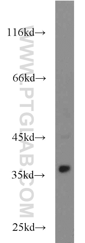 Western Blot (WB) analysis of mouse liver tissue using STUB1 Polyclonal antibody (55430-1-AP)