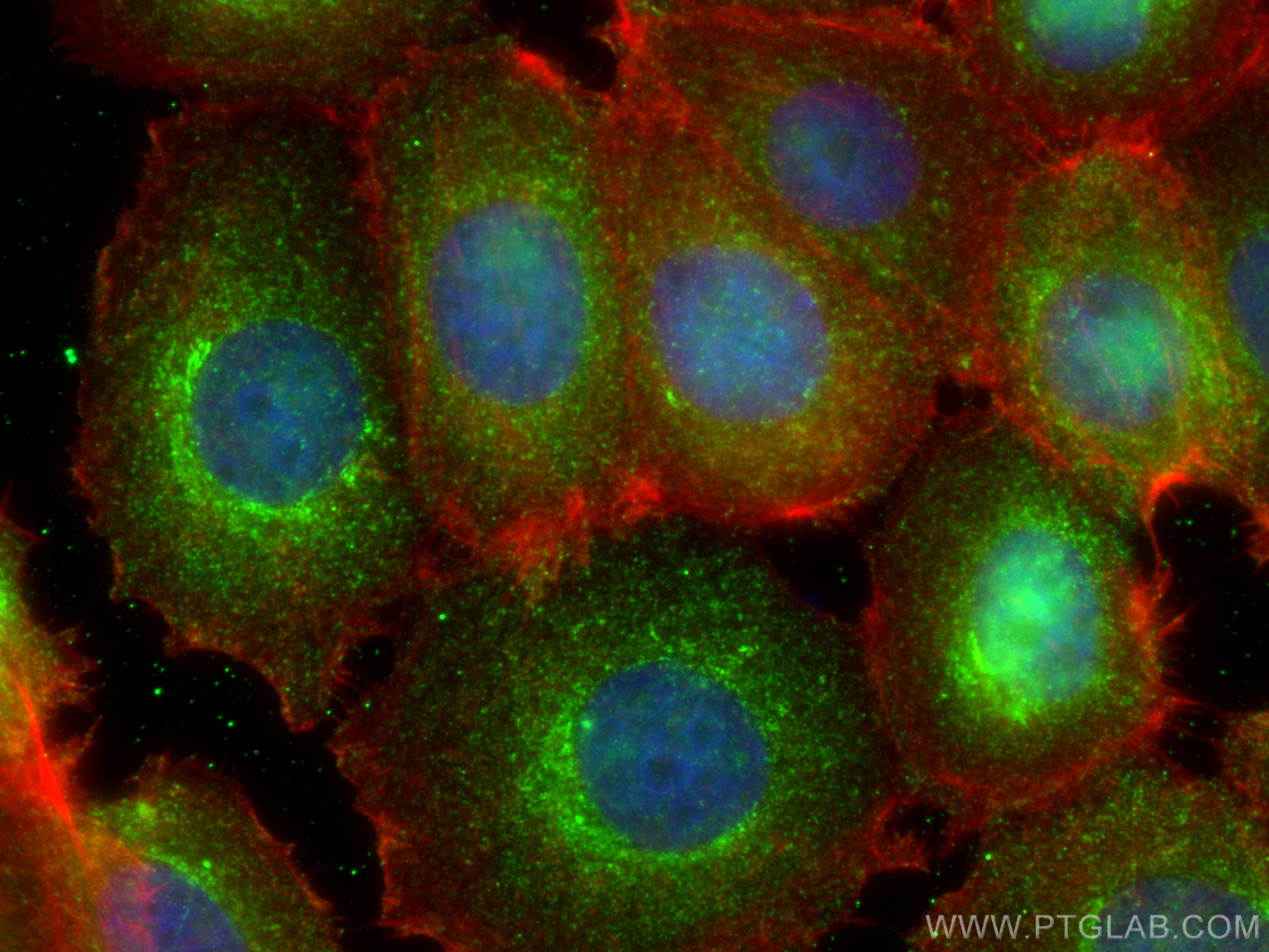 Immunofluorescence (IF) / fluorescent staining of MCF-7 cells using STUB1 Monoclonal antibody (68407-1-Ig)