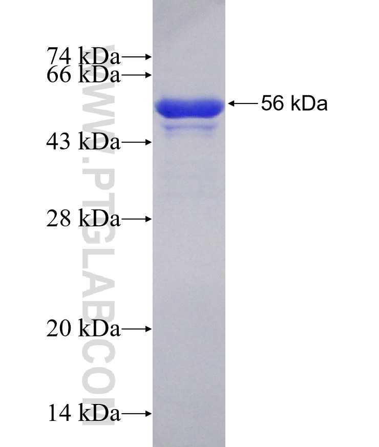 STUB1 fusion protein Ag31335 SDS-PAGE