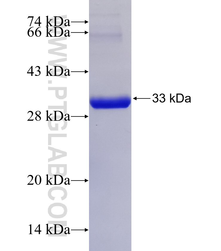 STUB1 fusion protein Ag31348 SDS-PAGE