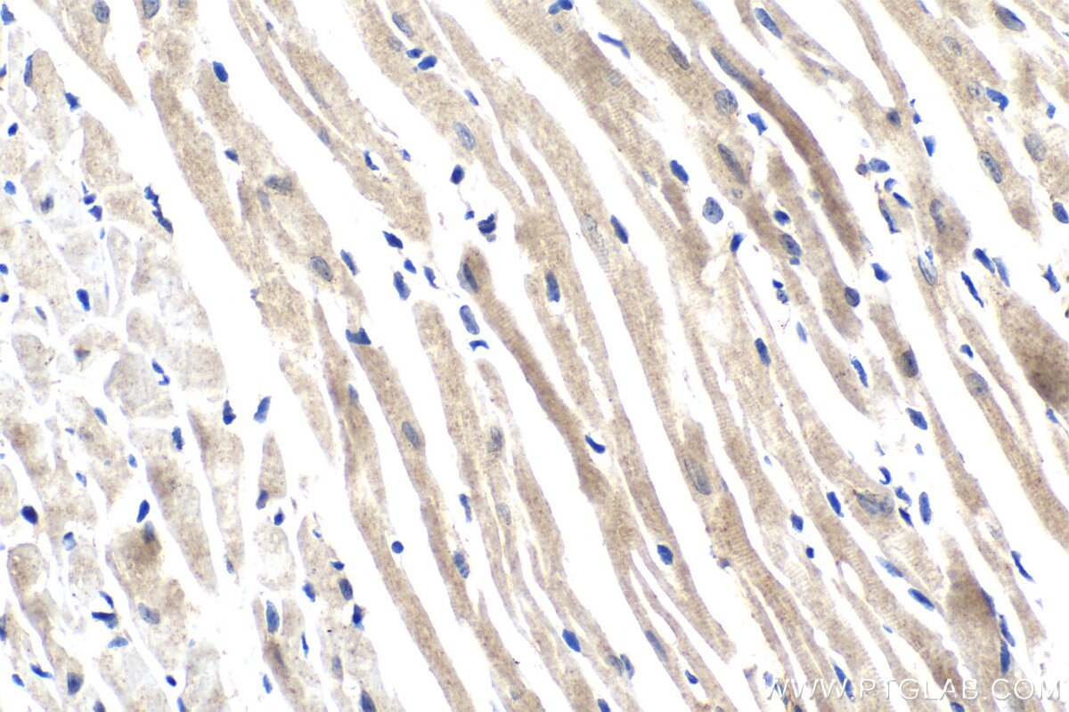 Immunohistochemistry (IHC) staining of mouse heart tissue using Syntaxin 10 Polyclonal antibody (11036-1-AP)