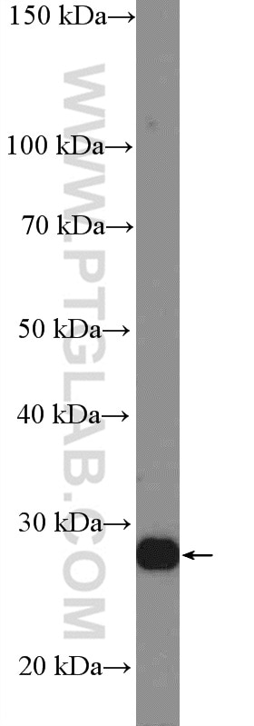 WB analysis of MCF-7 using 11036-1-AP