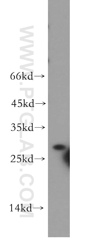 WB analysis of BxPC-3 using 11036-1-AP