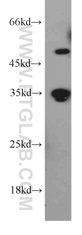 Western Blot (WB) analysis of human skeletal muscle tissue using Syntaxin 11 Polyclonal antibody (13301-1-AP)